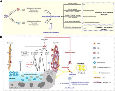 Macrophage polarization in osteoarthritis progression: a promising therapeutic target